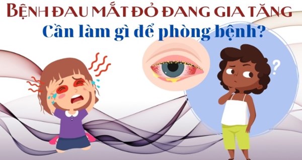 Cần làm gì để phòng tránh đau mắt đỏ